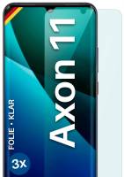 moex FlexProtect Klar für ZTE Axon 11 – Schutzfolie für unsichtbaren Displayschutz, Ultra klar